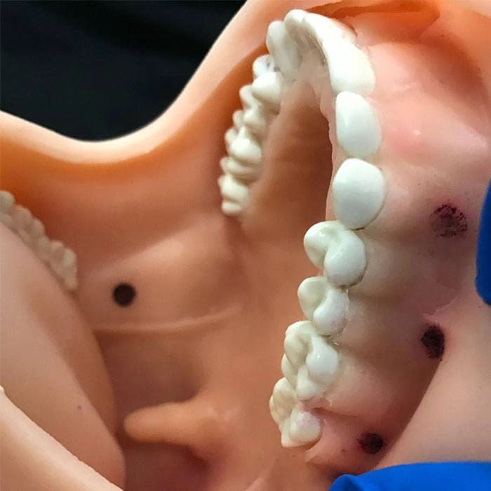 Oral Anesthesia Training Manikin with 10-Sensors