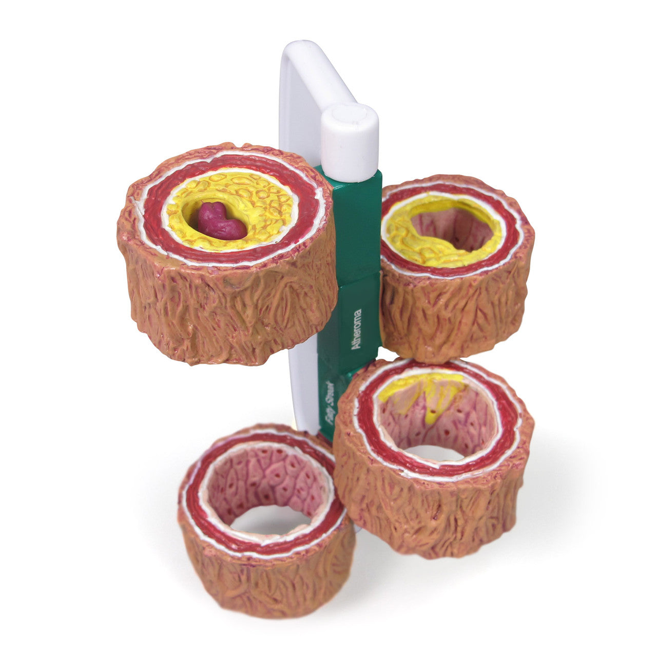 4-piece-artery-model-2a__83510.1642349867.1280.1280.jpg