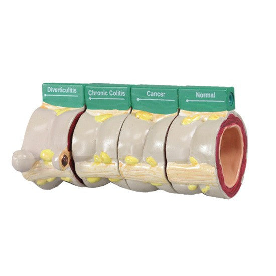 4-piece-colon-model-2__74575.1642350183.1280.1280.jpg
