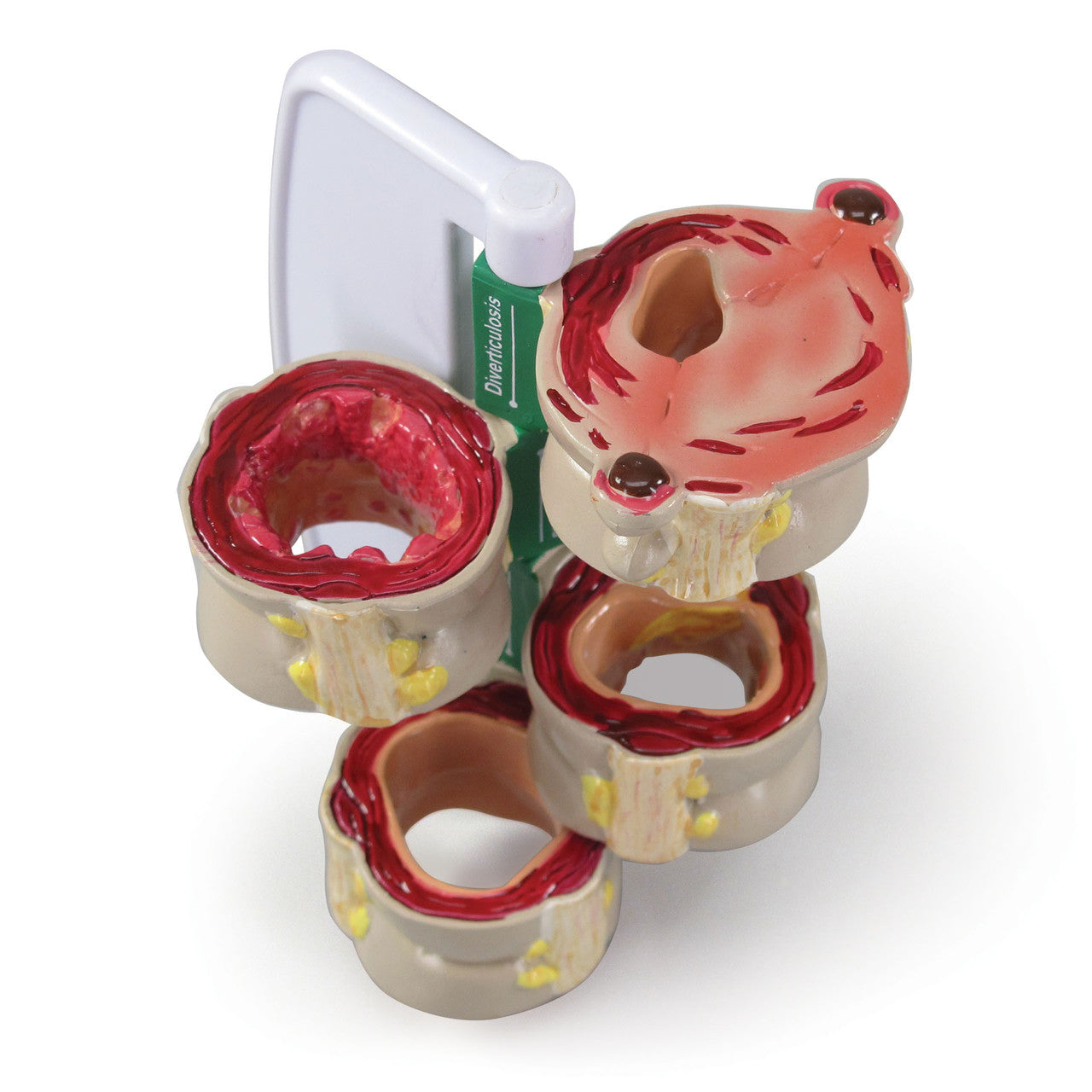 4-piece-colon-model-2a__50643.1642350184.1280.1280.jpg