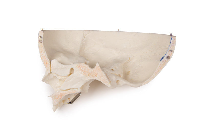 Luxury demonstration Children‘s skull, 14 parts
