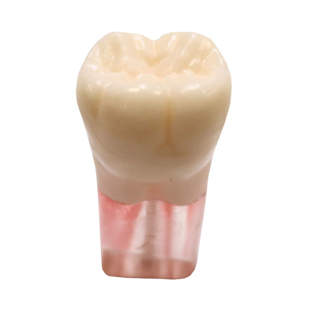 Nissin / Kilgore 700 Series S12 Endodontic Tooth with Clear Roots