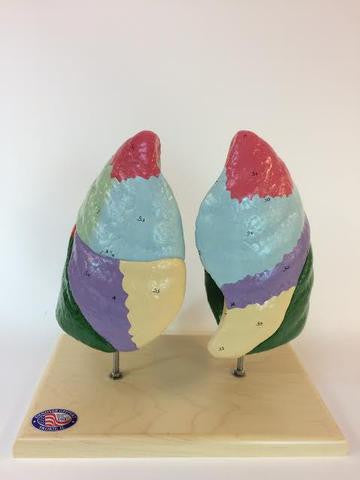 0194-00 Color-Coded Segmented Lungs
