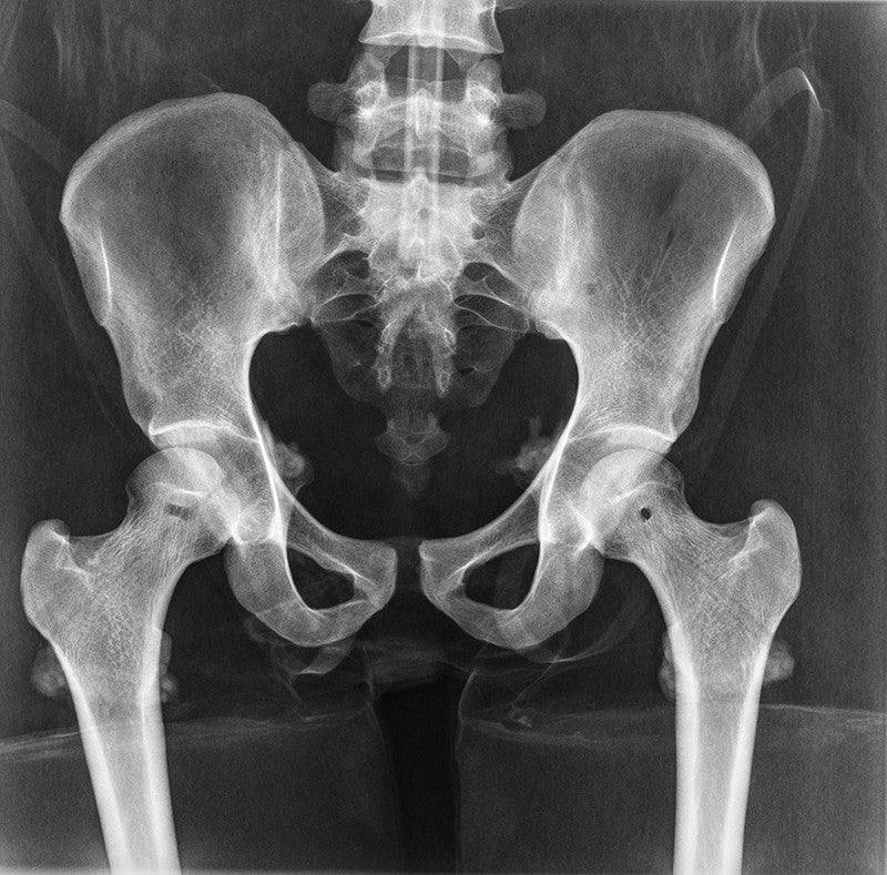 Full Body X-Ray Phantom - Pelvis