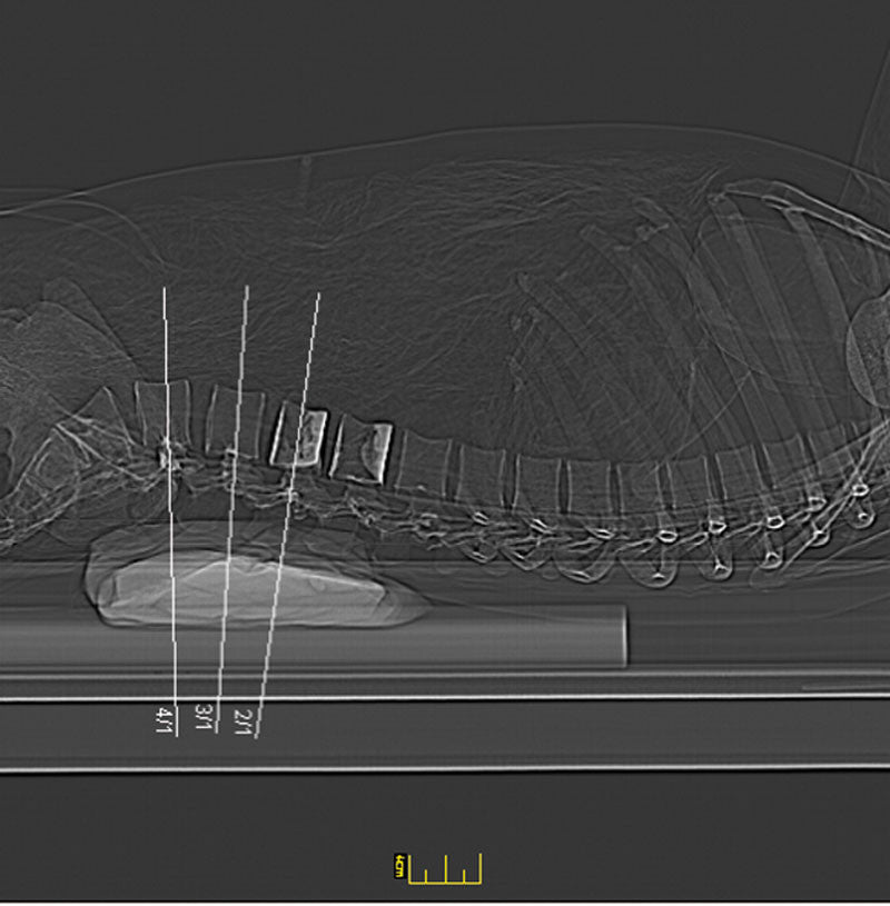 Full Body X-Ray Phantom