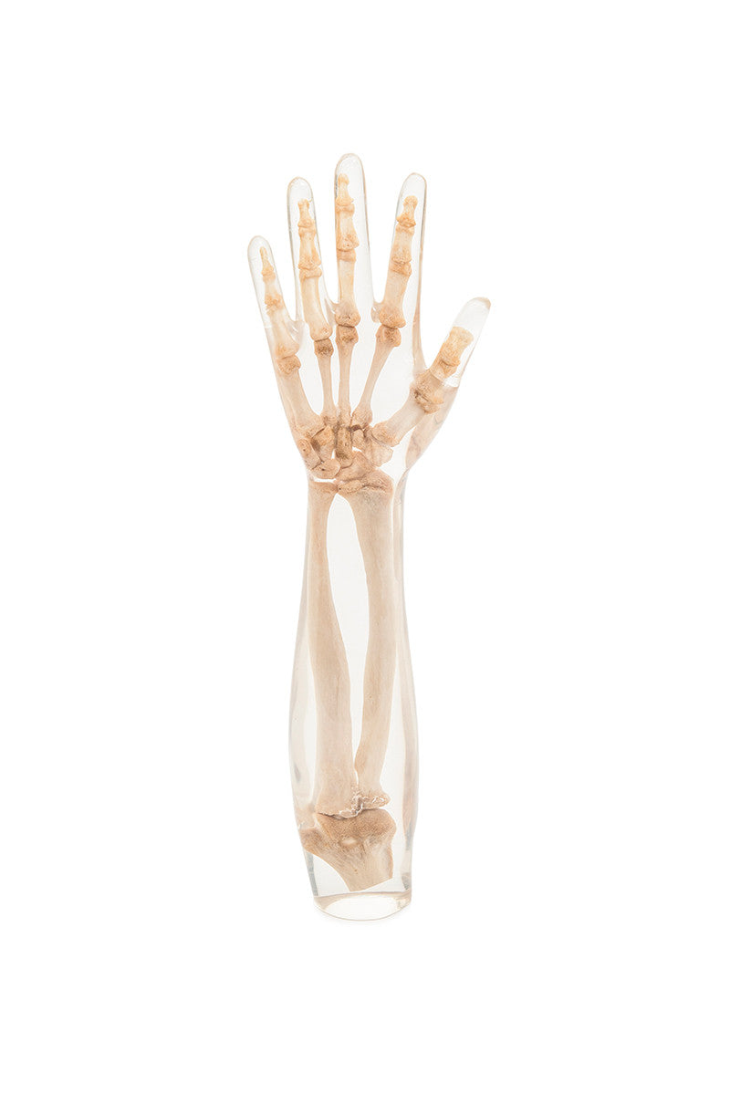X-Ray Phantom Lower Arm, transparent