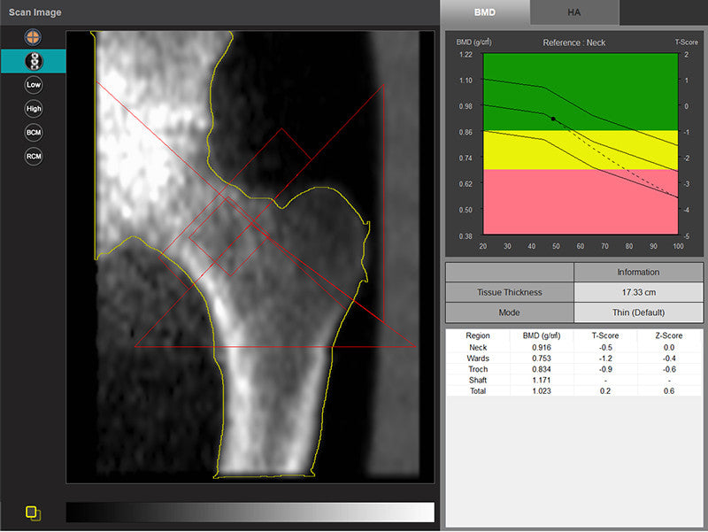 X-Ray phantom pelvis, transparent