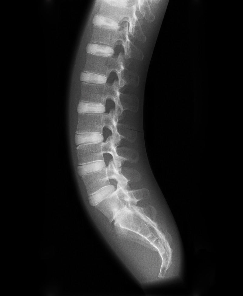 X-Ray Phantom Spine