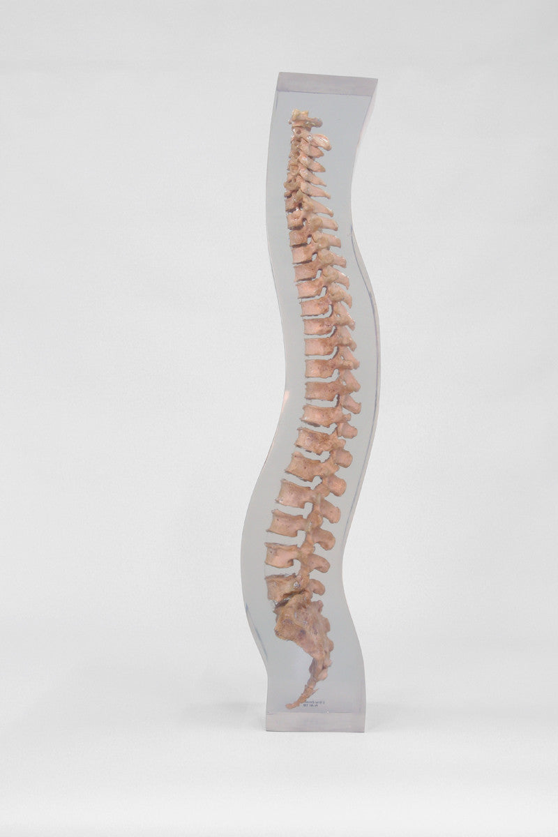X-Ray Phantom Spine