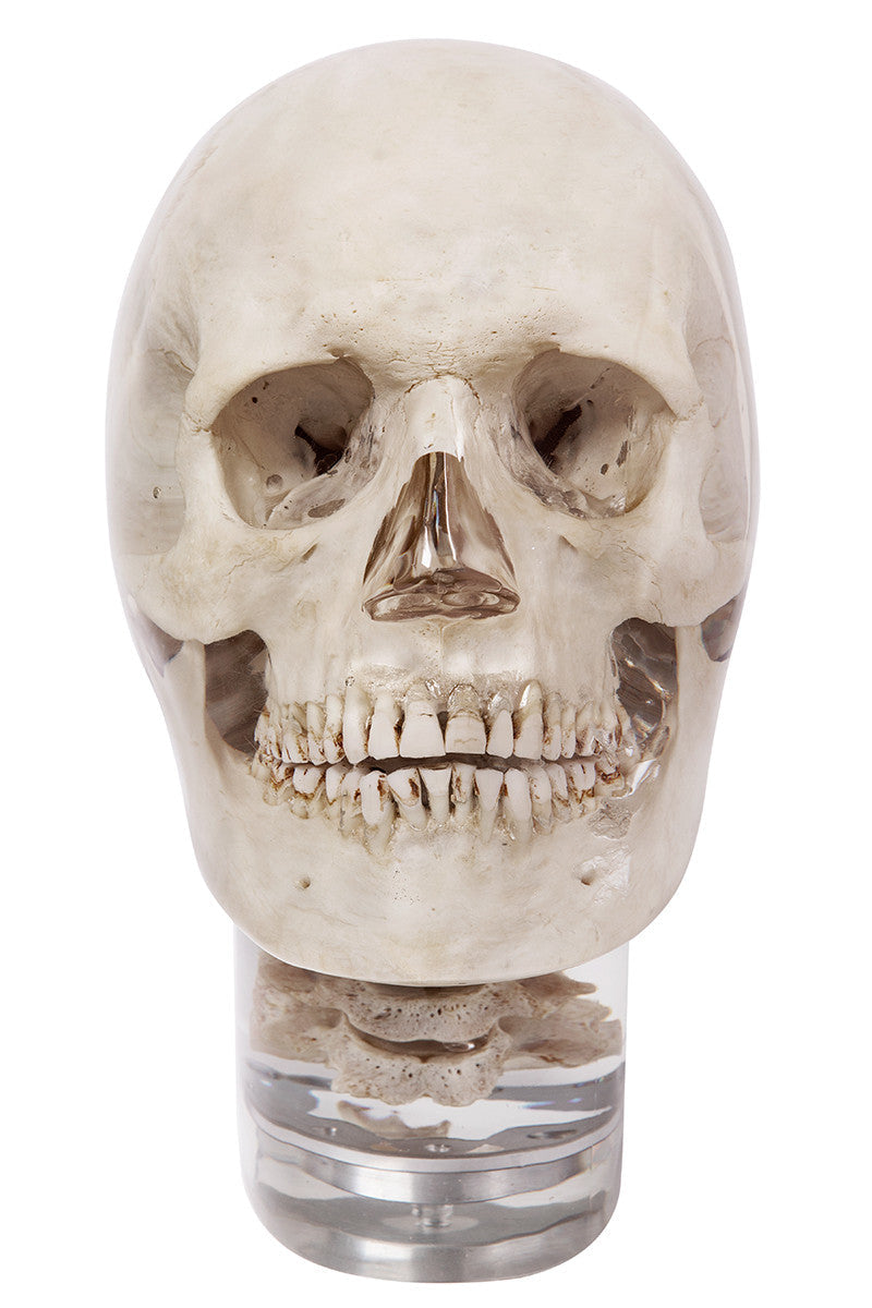 X-ray phantom head with cervical vertebrae, transparent