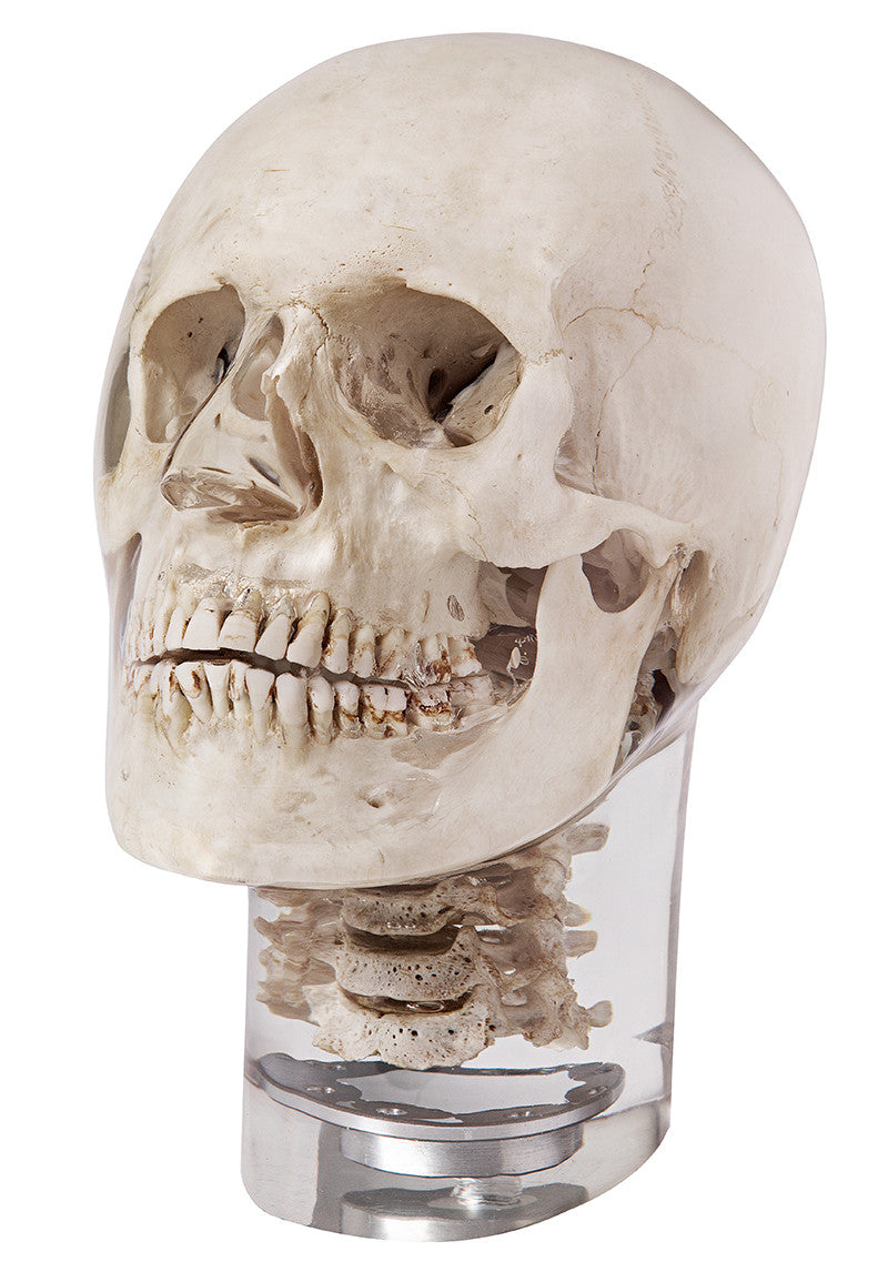 X-ray phantom head with cervical vertebrae, transparent