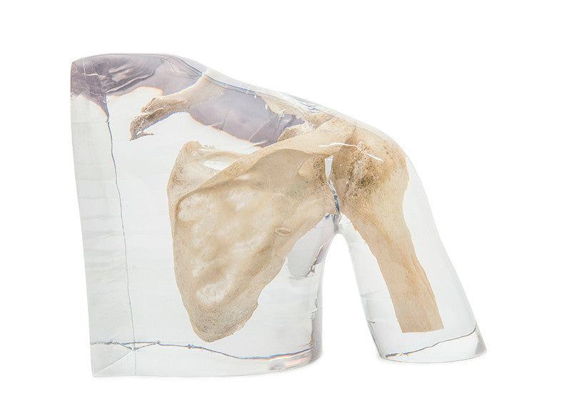 X-ray phantom shoulder, transparent