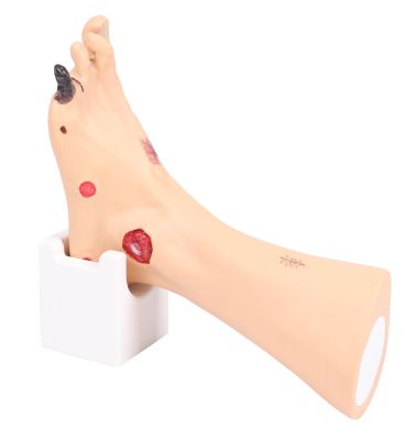 wiloma sex doll Advanced Wound Care Simulators & Training Models