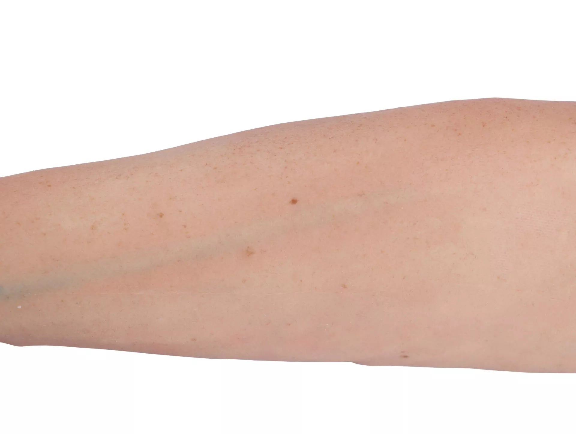 Puncture Pete IV Training Arm, light skin