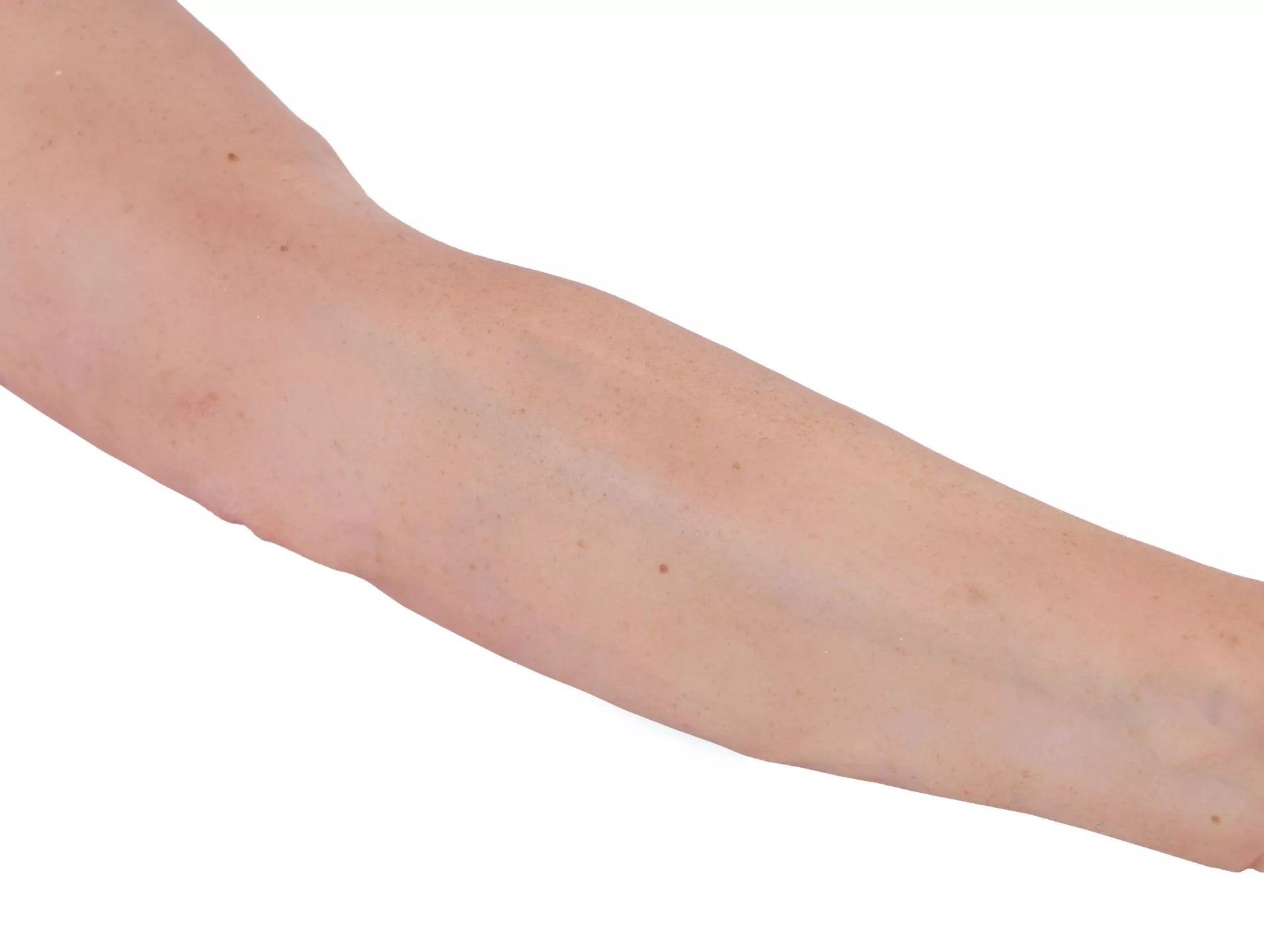 Puncture Pete IV Training Arm, light skin