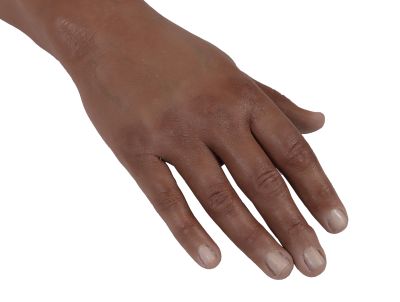 Puncture Pete – hyperrealistic IV training arm, dark skin color