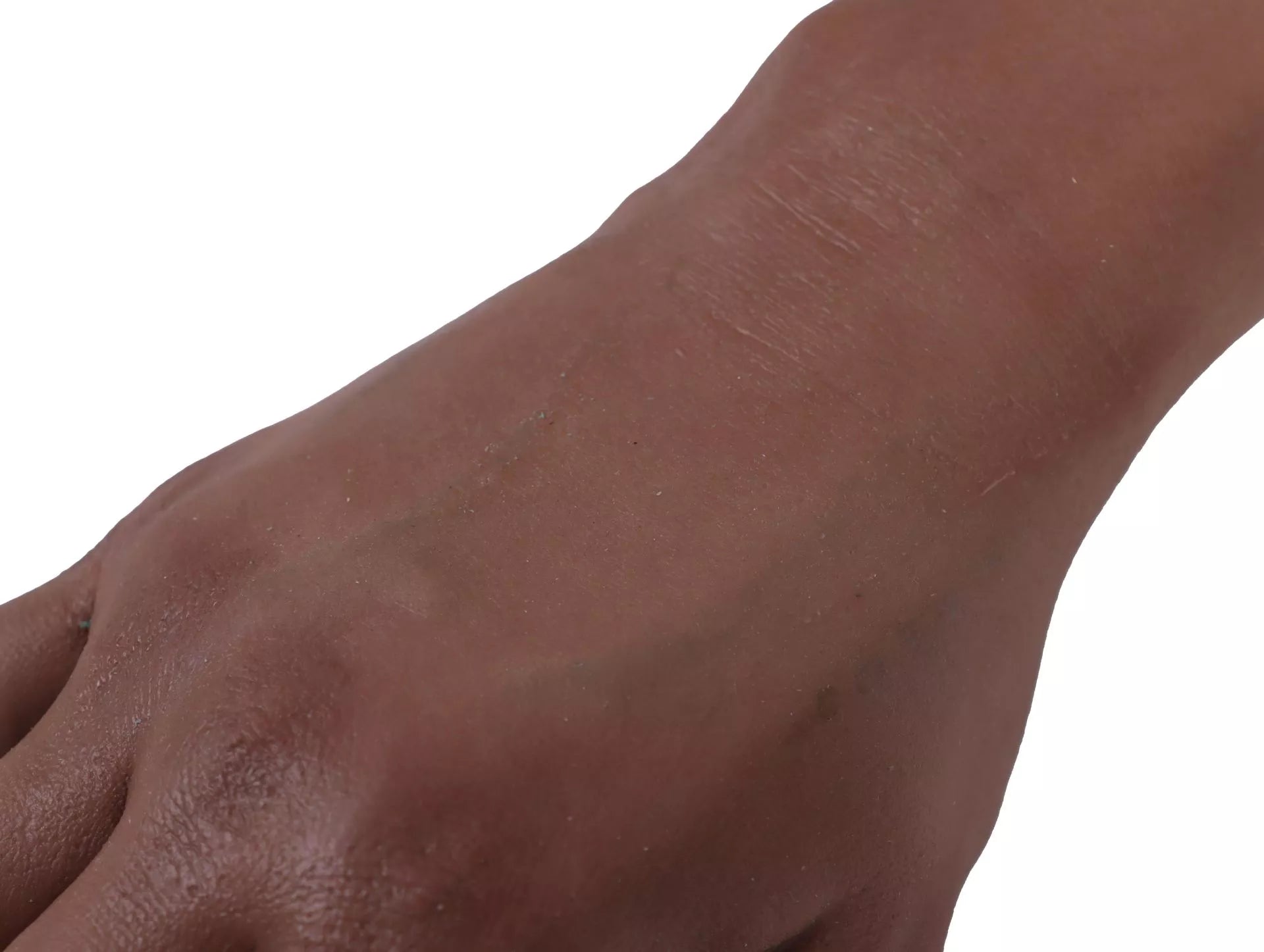 Puncture Pete IV Training Arm, dark skin