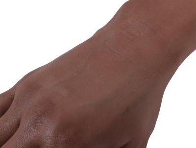 Puncture Pete – hyperrealistic IV training arm, dark skin color