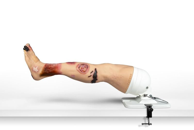 "Lena Leg" - Leg with medical conditions