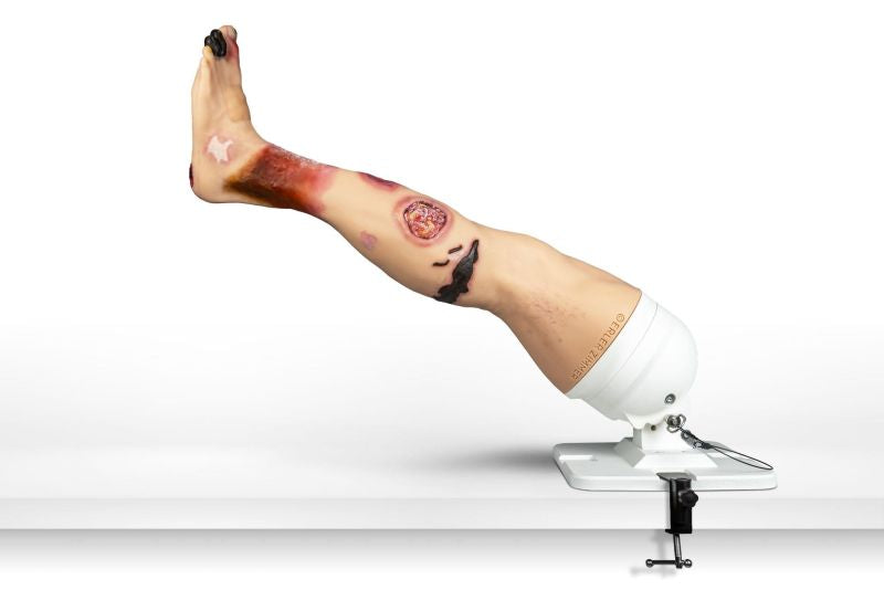 "Lena Leg" - Leg with medical conditions