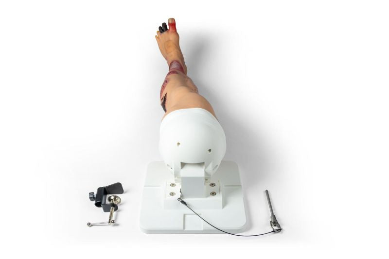 "Lena Leg" - Leg with medical conditions