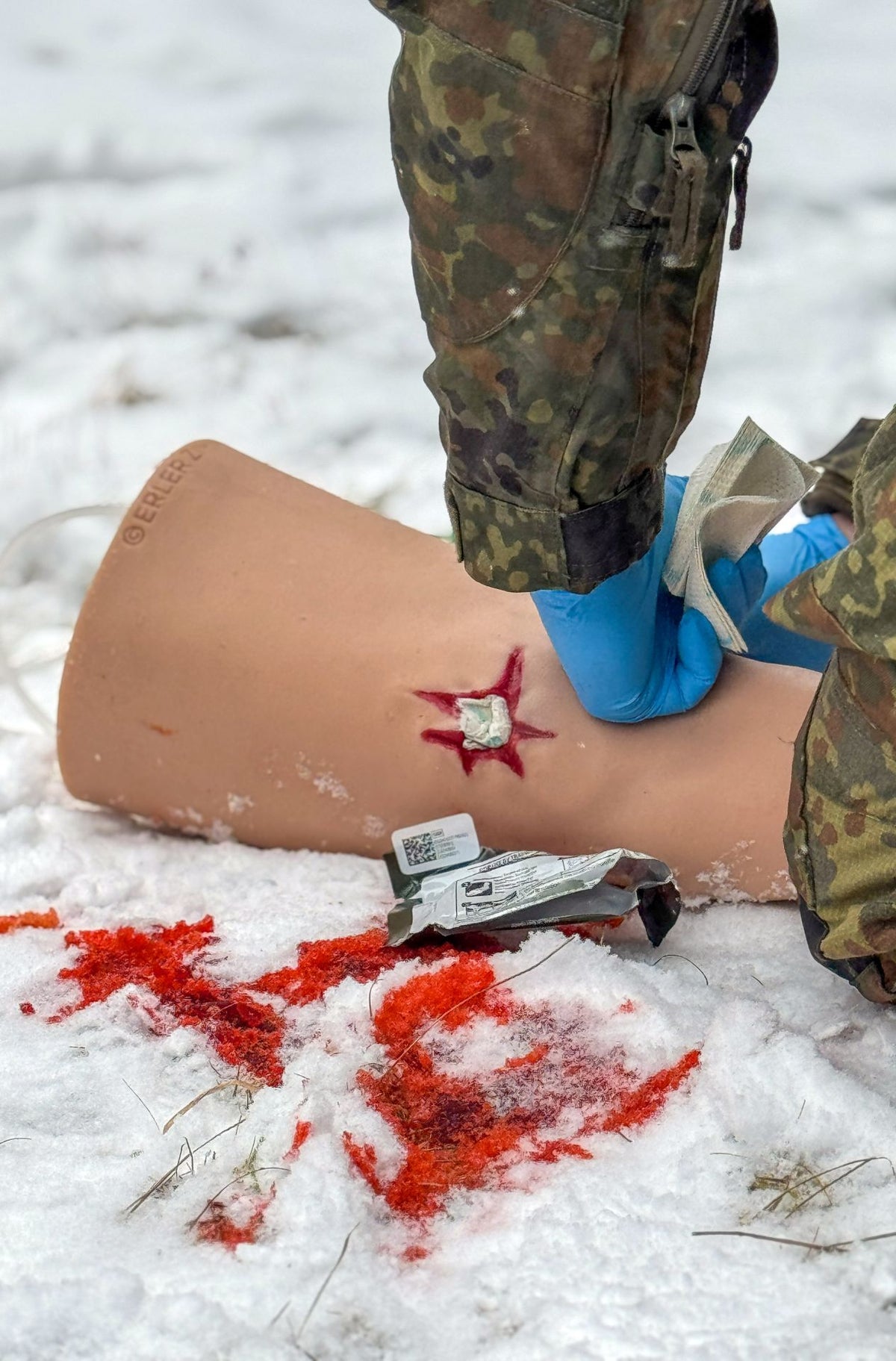 “Trauma Tim” - Leg with heavily bleeding wounds | Erler-Zimmer 7840