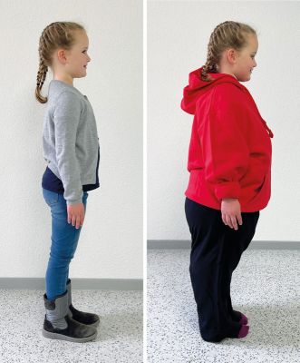 PAT Junior – Child Adipositas Trainer - Erler-Zimmer 8003, view 2