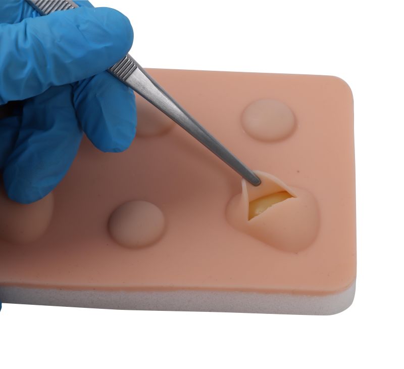 Training Pad Cyst and abscess - Erler-Zimmer 8030, view 5