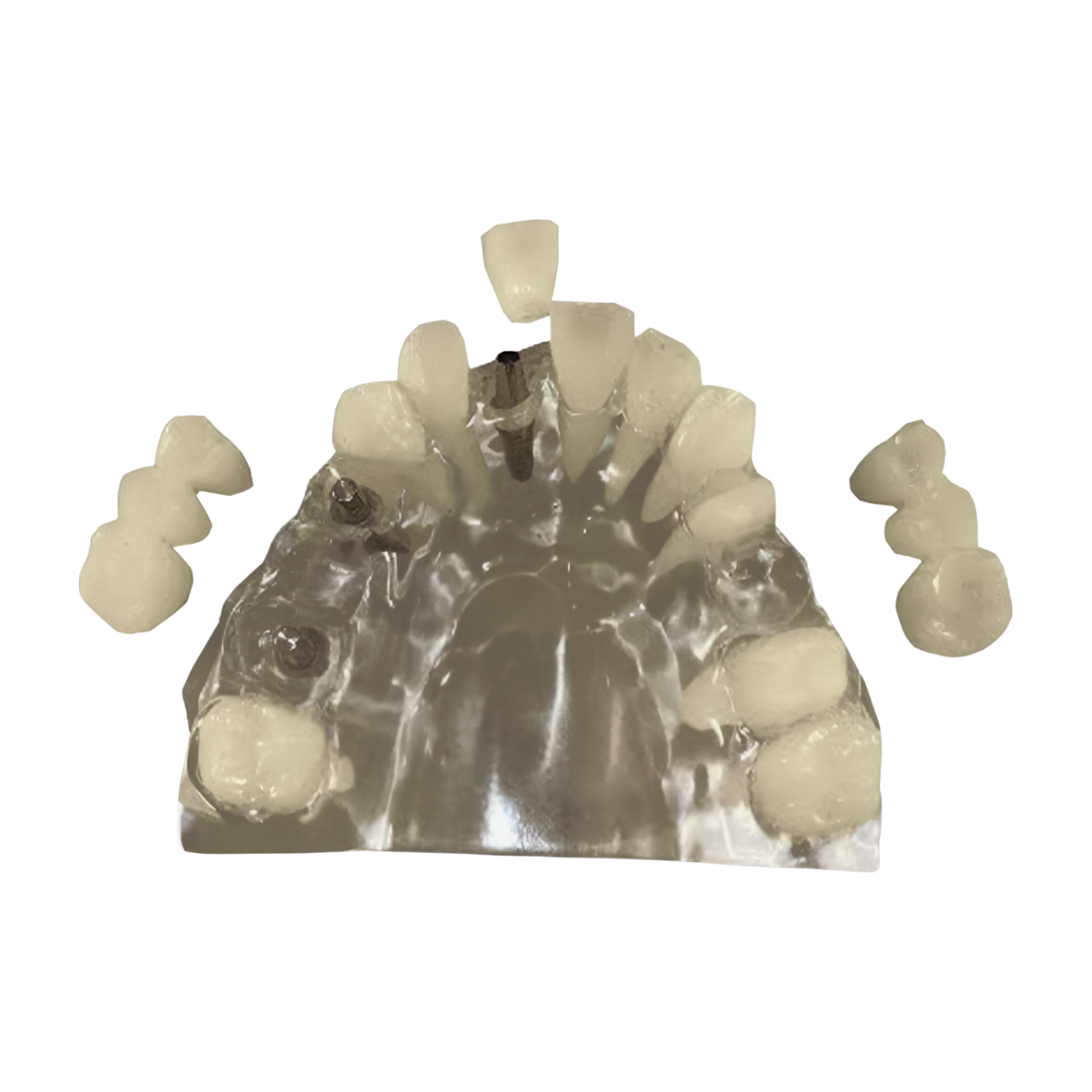 KPEK – Kilgore Patient Education Kit