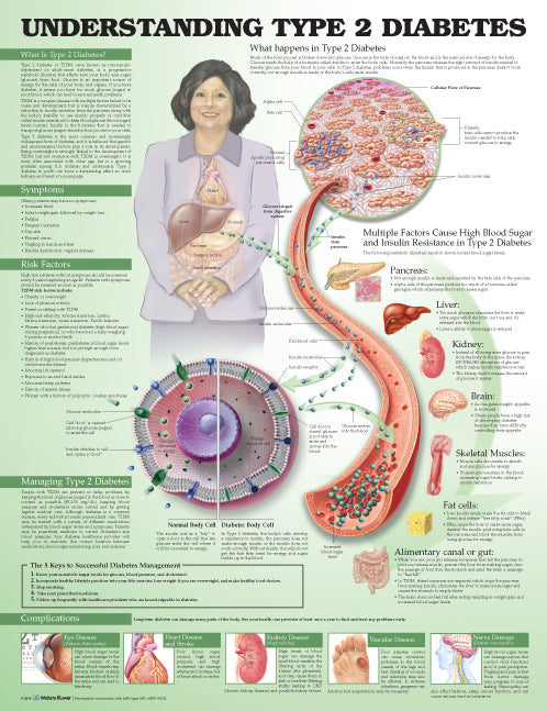 Understanding Type 2 Diabetes Anatomical Chart - 3rd Edition