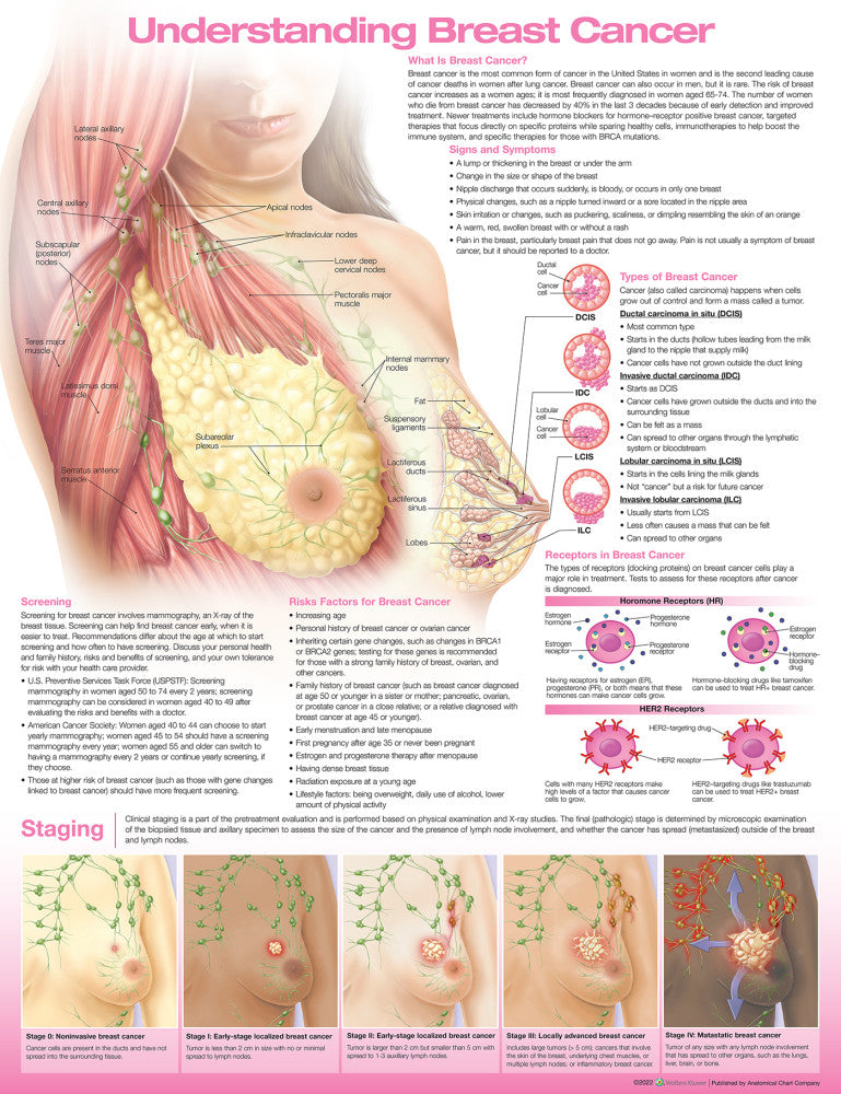 Understanding Breast Cancer Anatomical Chart - 4th Edition