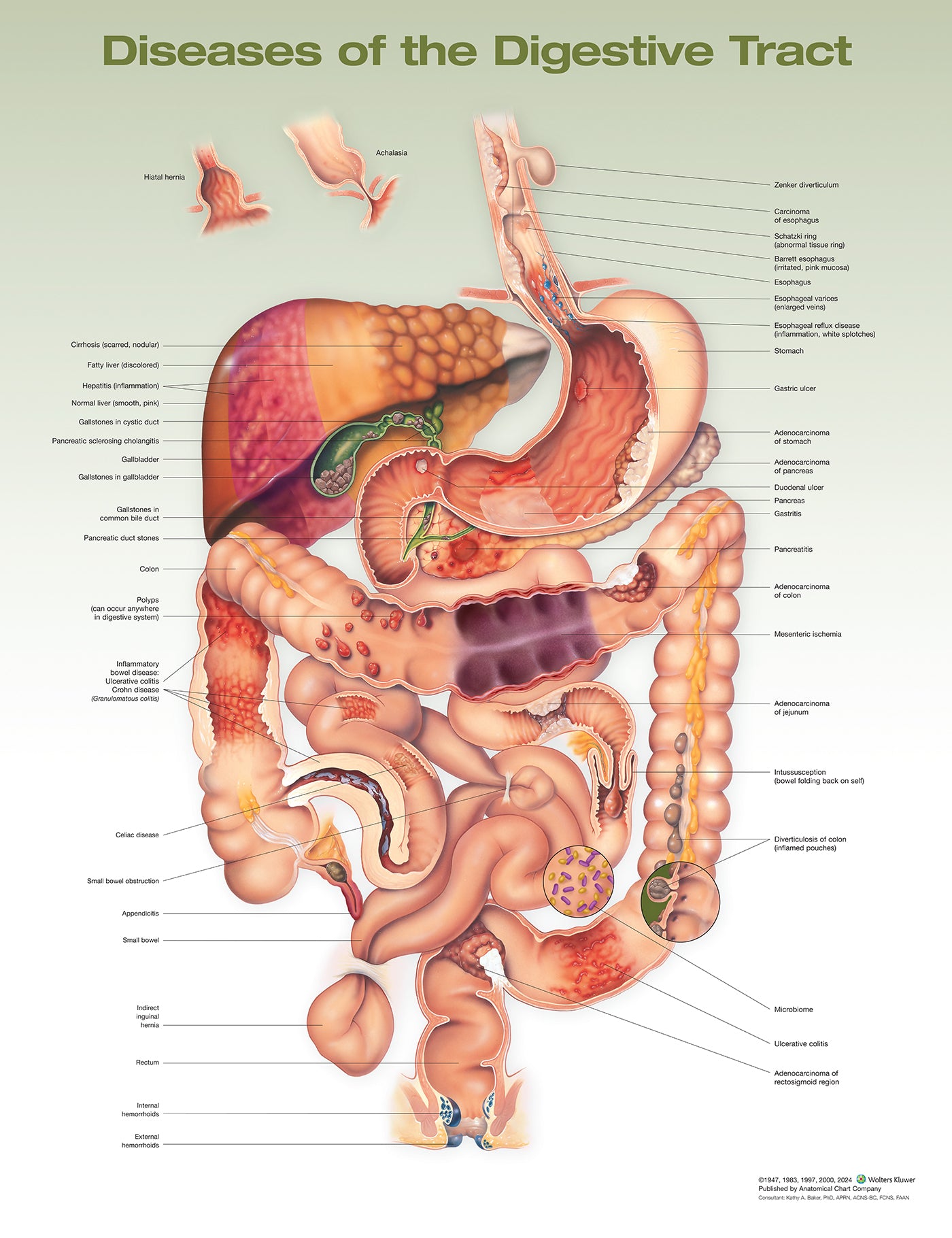 Diseases of the Digestive Tract, 2E