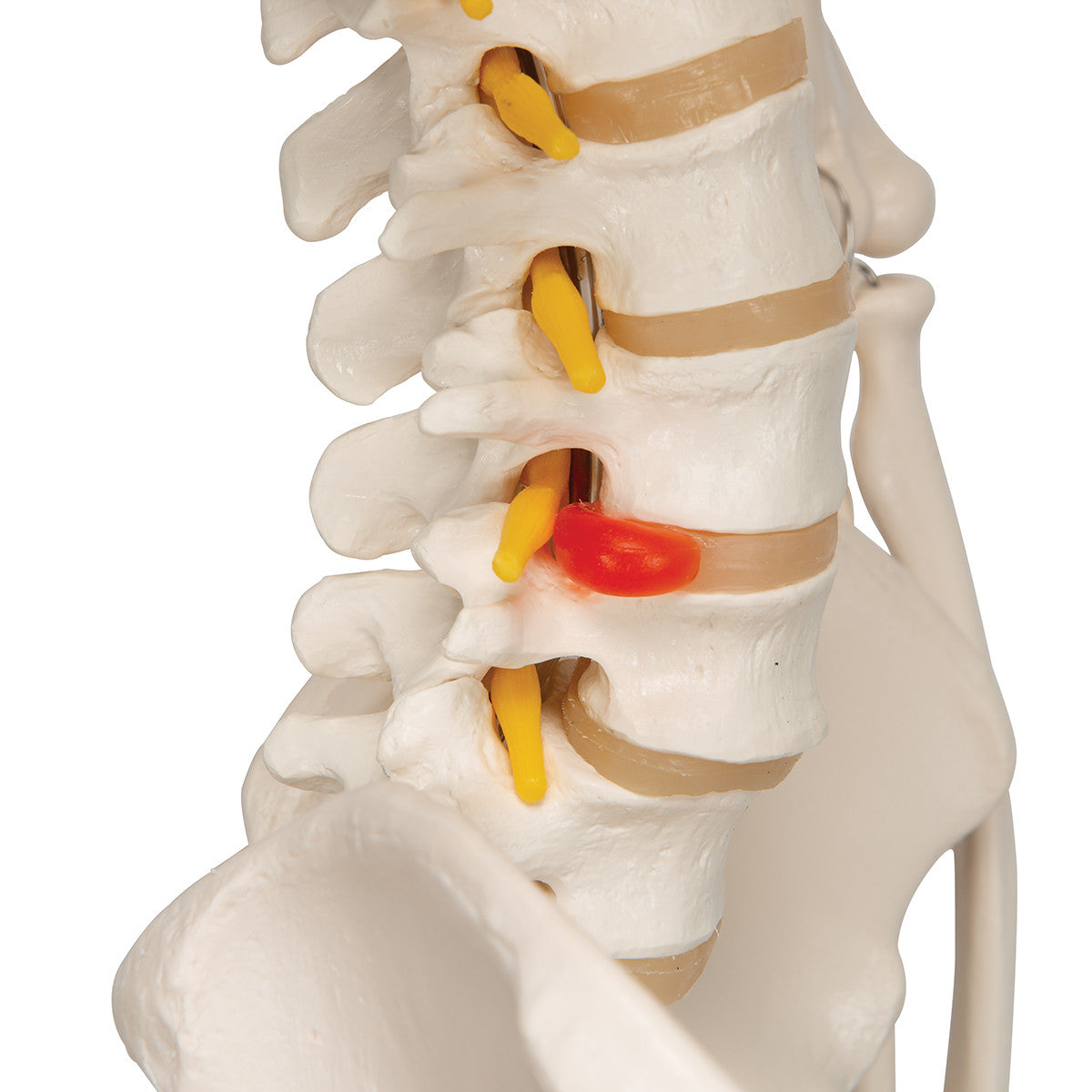 Standard Skeleton with Flexible Spine | 3B Scientific A15