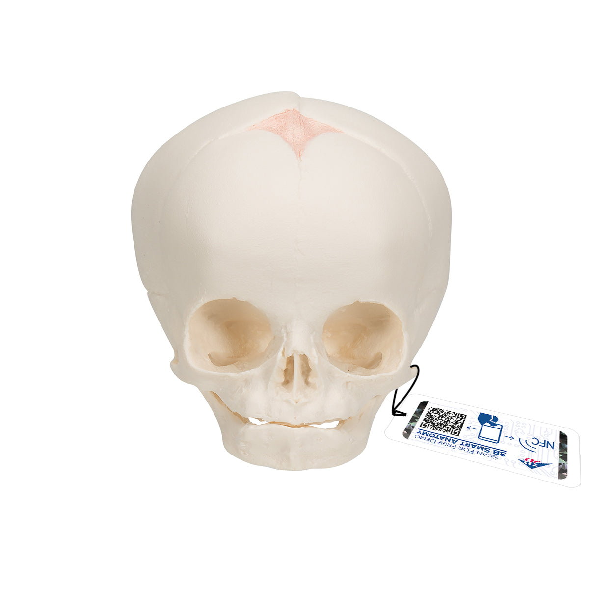 Fetal Skull