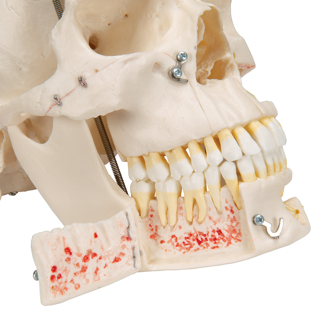 Deluxe Human Demonstration Dental Skull Model, 10 part - 3B Scientific A27, view 6