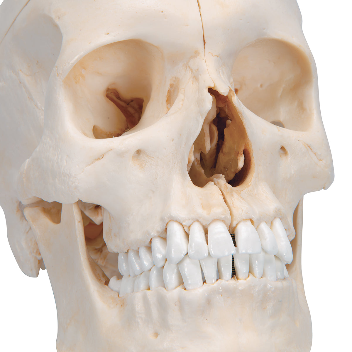 BONElike Human Bony Skull Model, 6 part - 3B Scientific A281, view 6