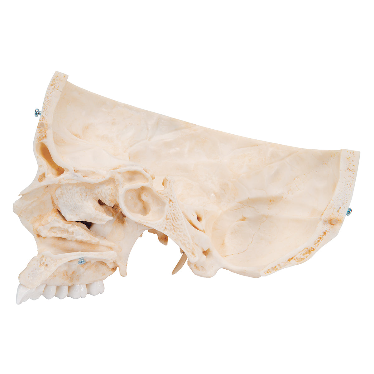 BONElike Human Bony Skull Model, 6 part - 3B Scientific A281, view 7