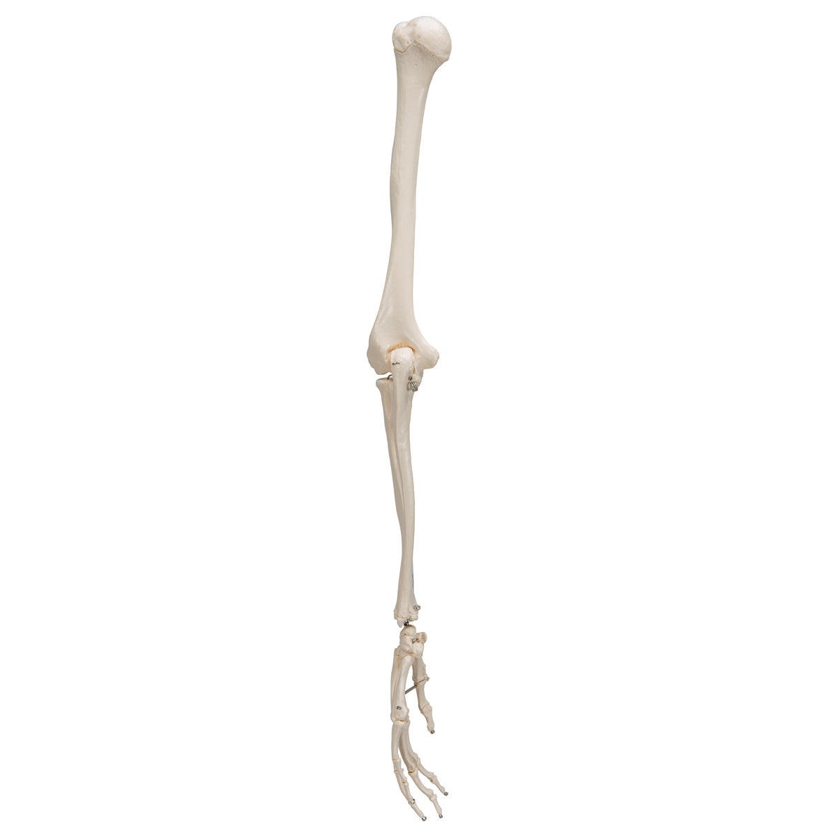 Arm Skeleton
