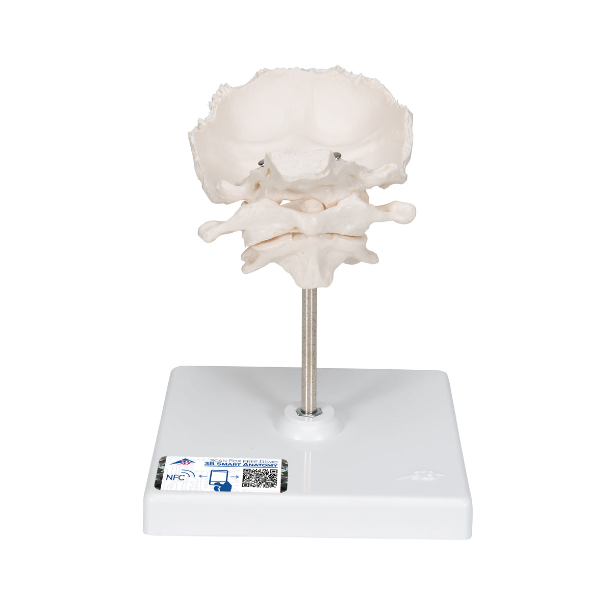 Atlas & Axis Model with Occipital Plate, Wire Mounted, on Removable Stand