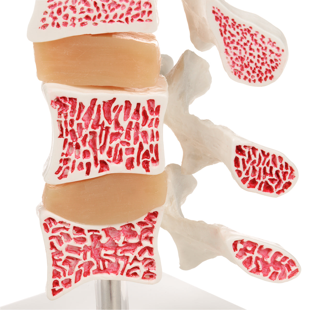 Deluxe Human Osteoporosis Model (3 Vertebrae with Discs), Removable on Stand - 3B Scientific A78, view 10