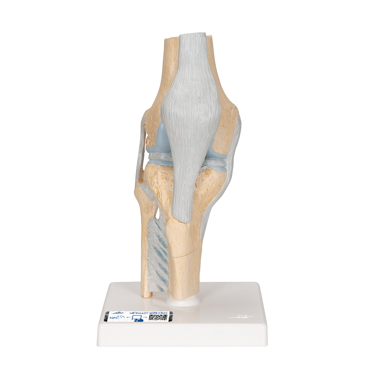 Sectional Human Knee Joint Model, 3 part - 3B Scientific A89, view 8