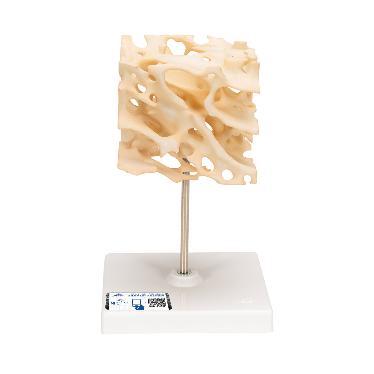 Human Cancellous Bone Model, Enlarged 100 times