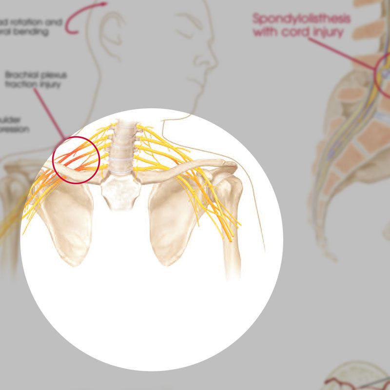 Anatomy and Injuries of the Spine Chart - detail