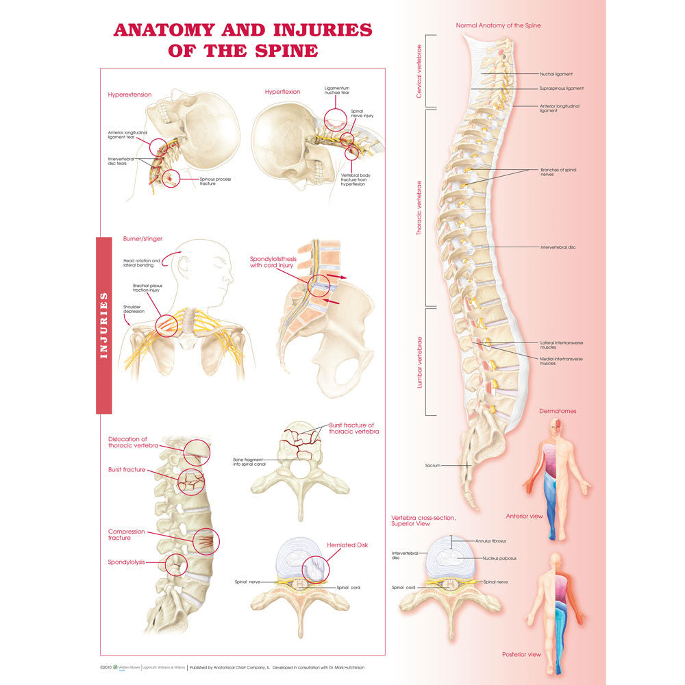 Anatomy and Injuries of the Spine Chart