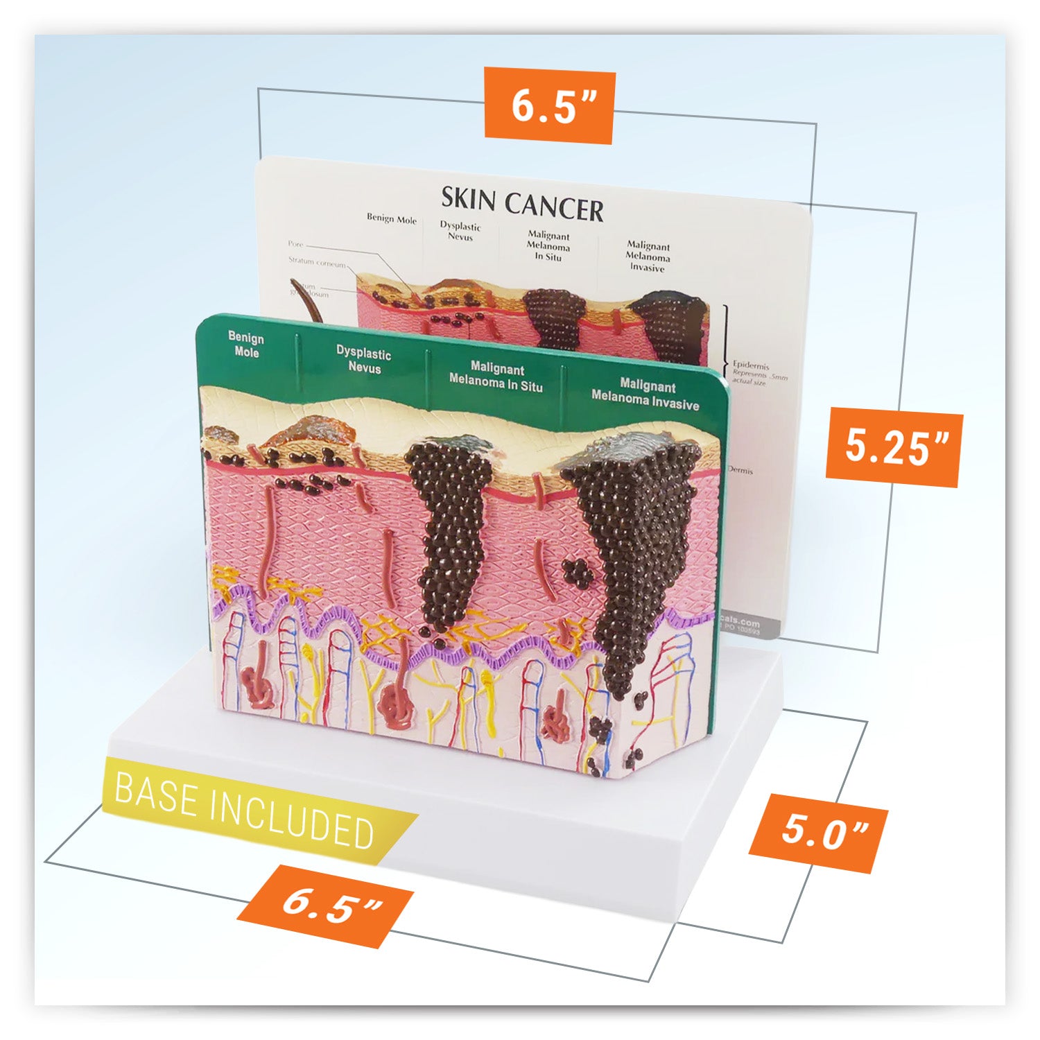 Skin Cancer Model