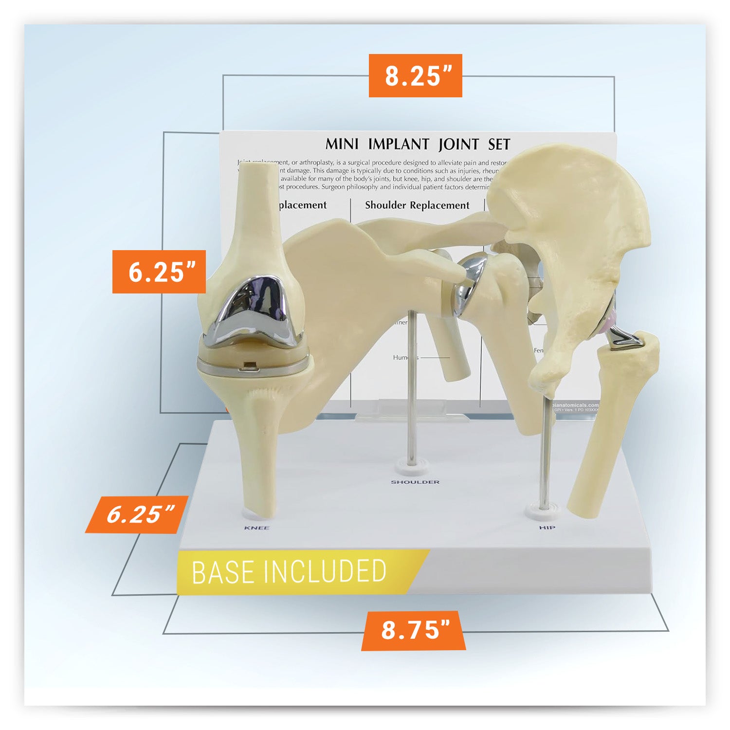Mini-Implant Joint Set (NEW! Model)
