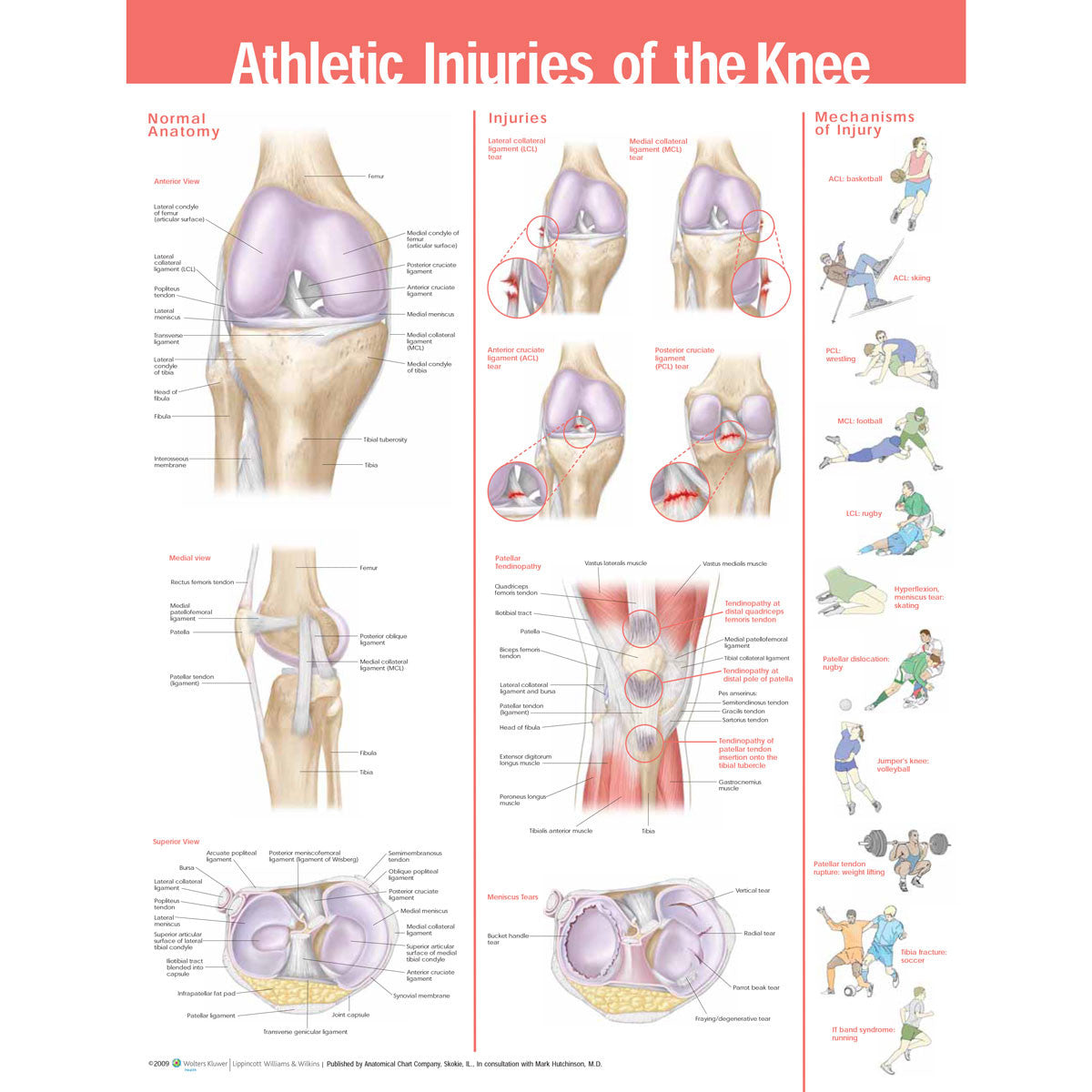 Athletic Injuries of the Knee chart