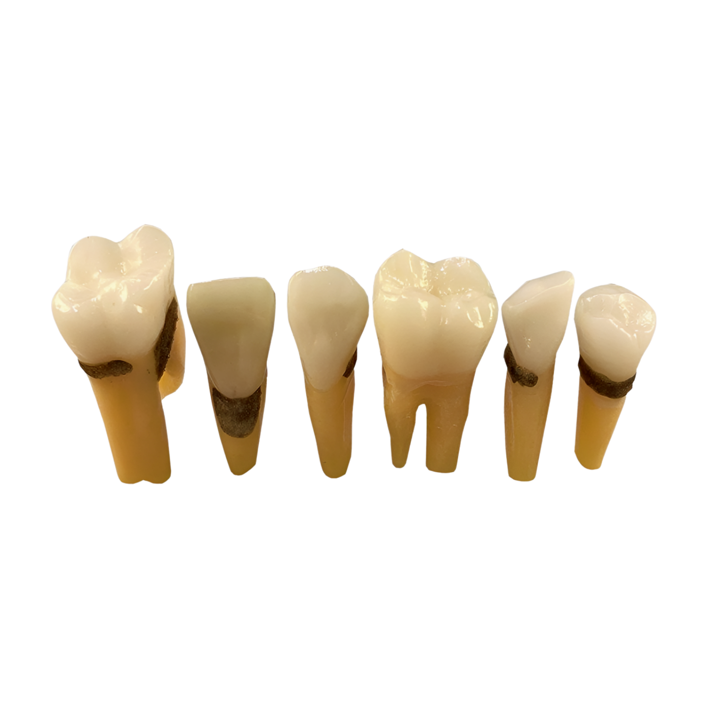 Replacement teeth for TR56 Hygiene model - with calculus