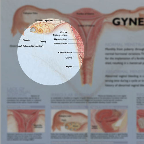 Common Gynecological Disorders Anatomical Chart - Detail