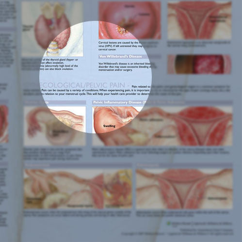Common Gynecological Disorders Anatomical Chart - Detail
